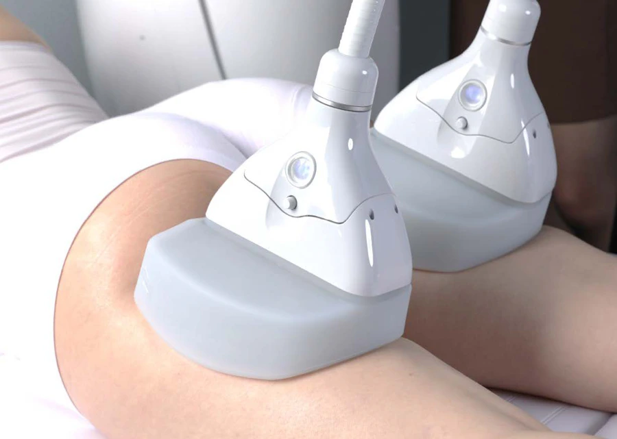 Clatuu fat freezing applicator on the thigh