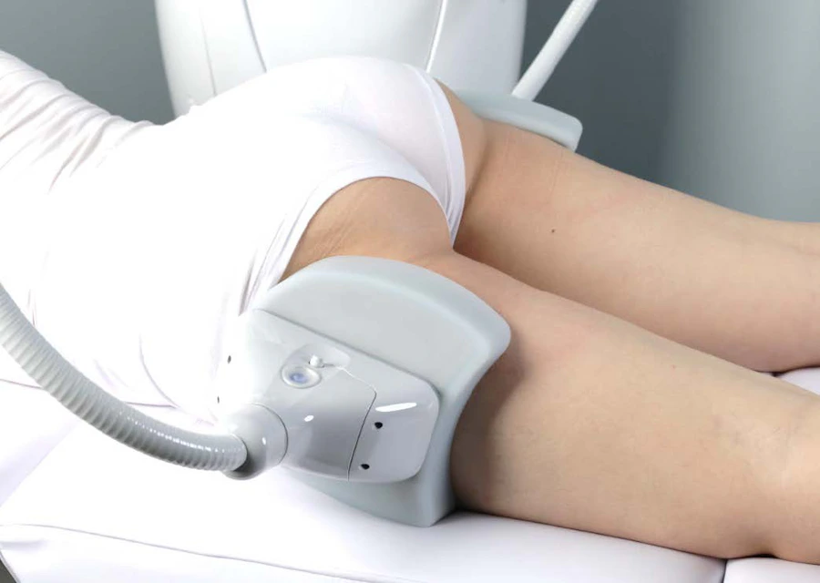 Clatuu fat freezing applicator below the buttocks