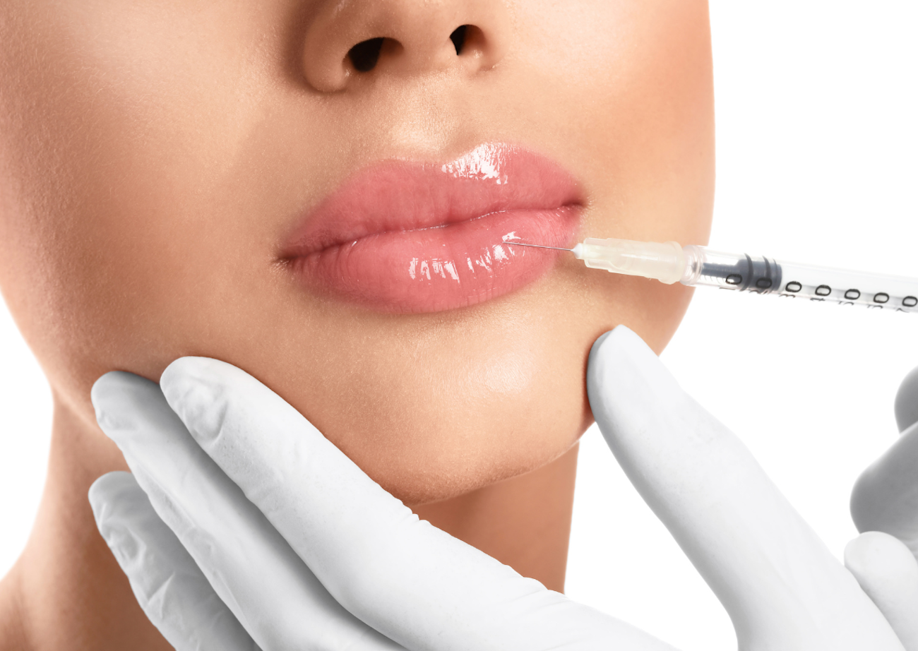 Everything You Need to Know About Lip Fillers