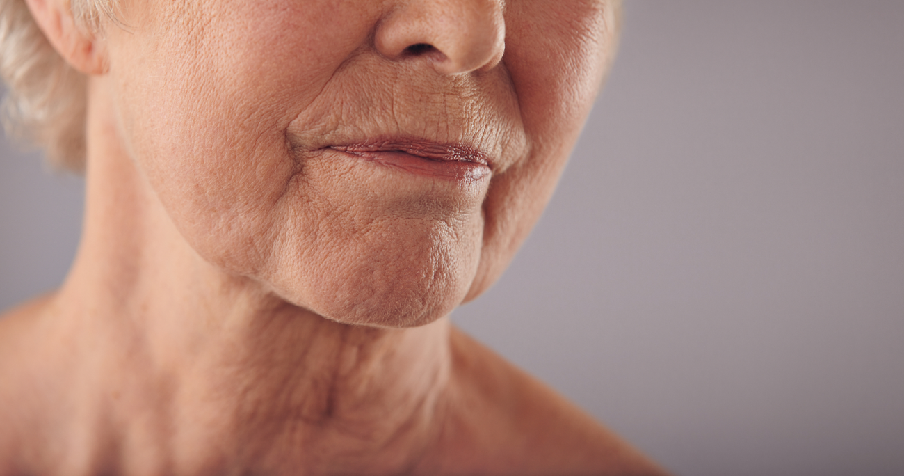 sagging skin treatment