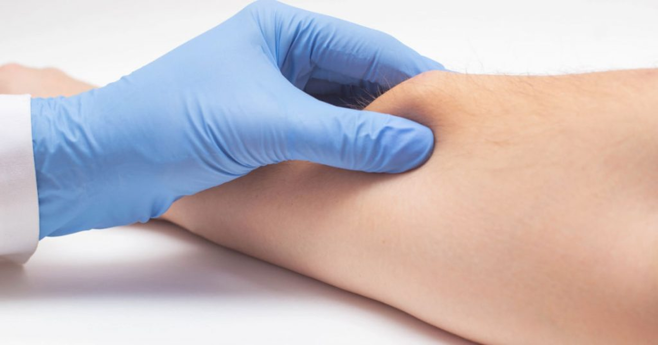 Quick Dermatology Treatments for Common Skin Concerns