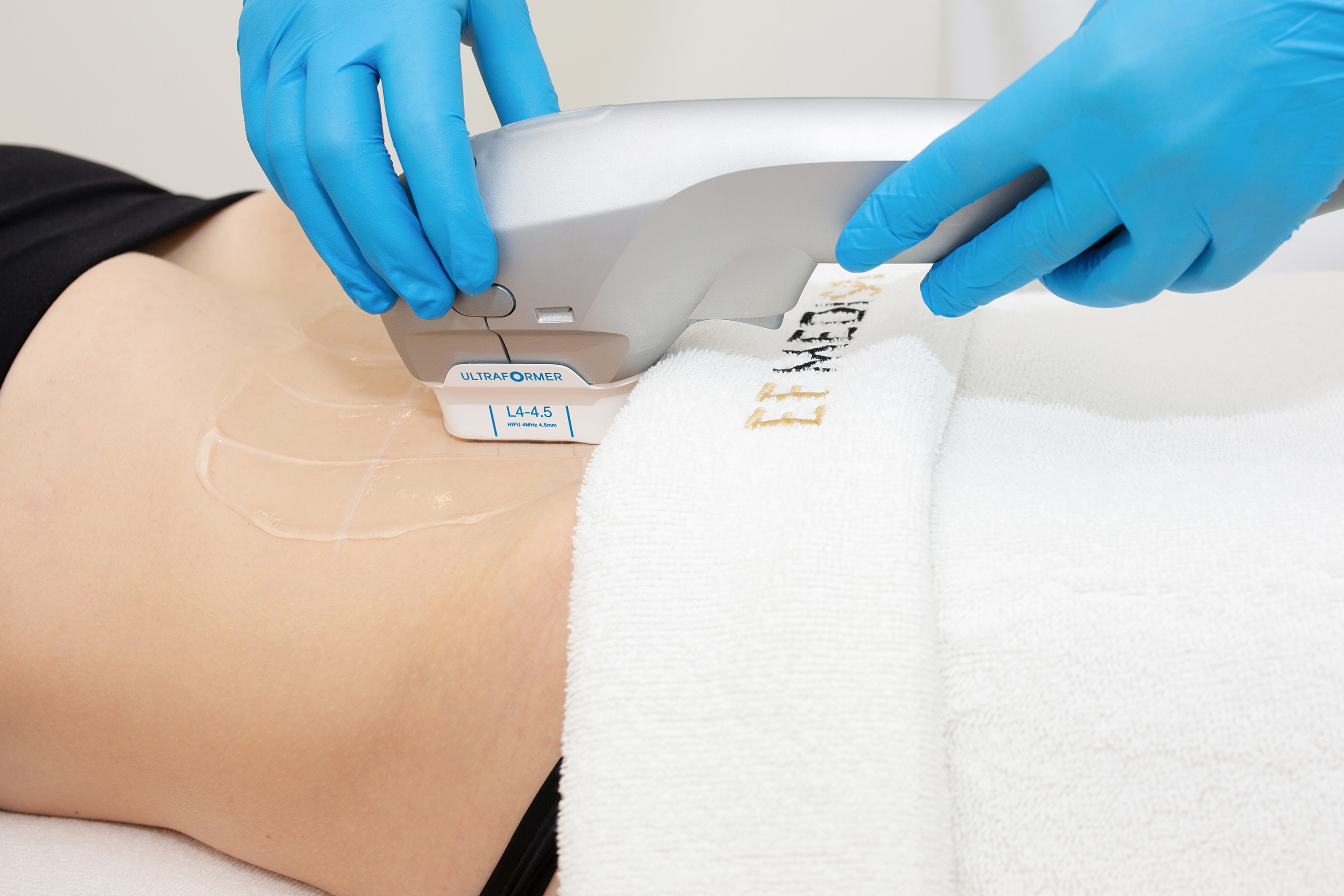 Why should have Ultraformer III at EF MEDISPA?