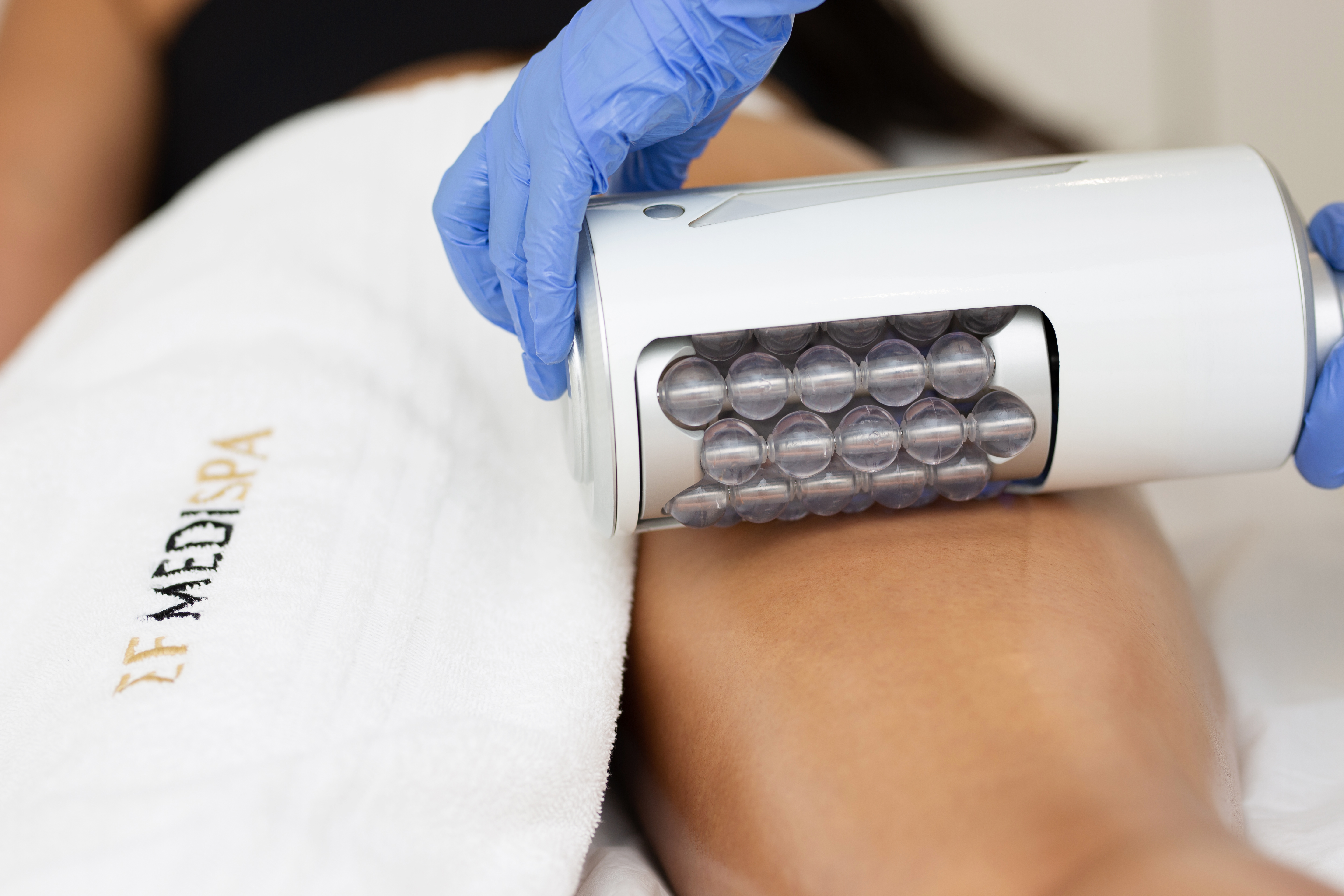 What is  VibroSculpt by Endosphères