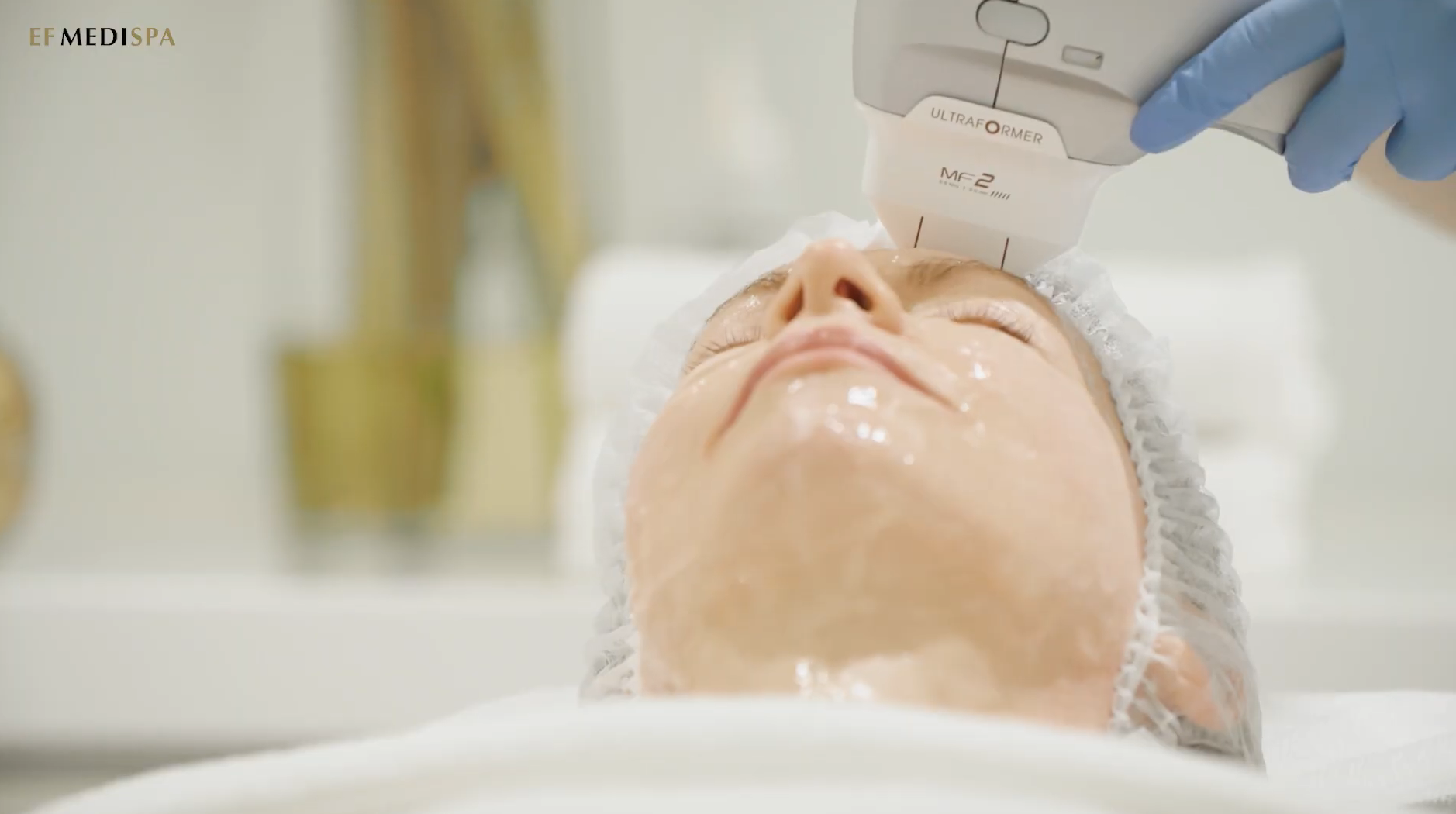 HIFU Facial at EF MEDISPA