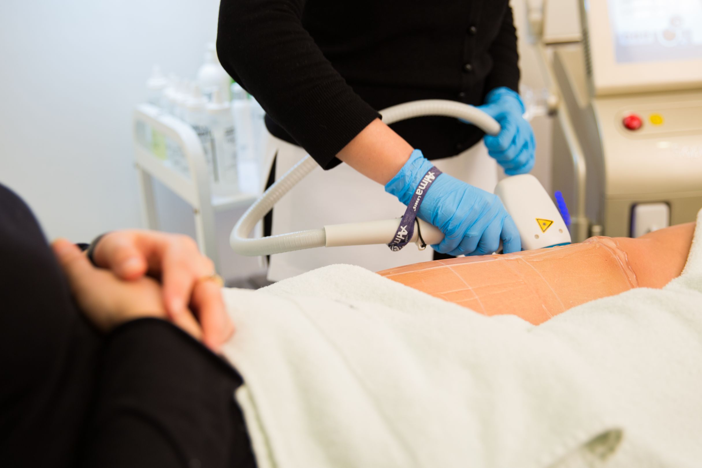 Laser hair removal at EF MEDISPA