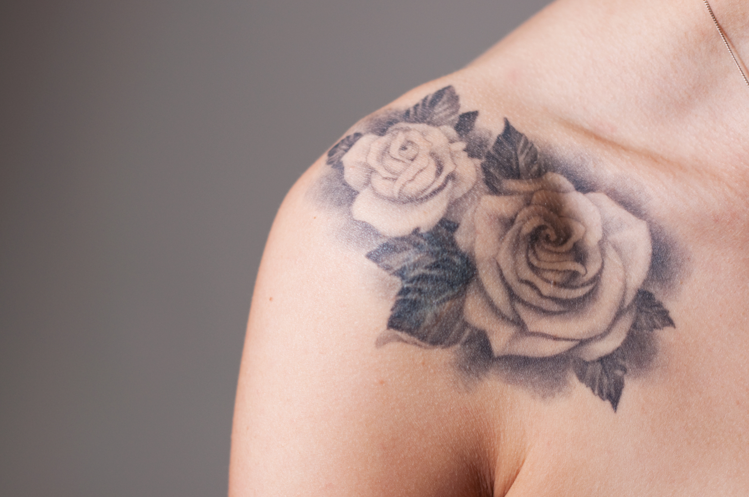 Laser tattoo removal treatment at EF Medispa