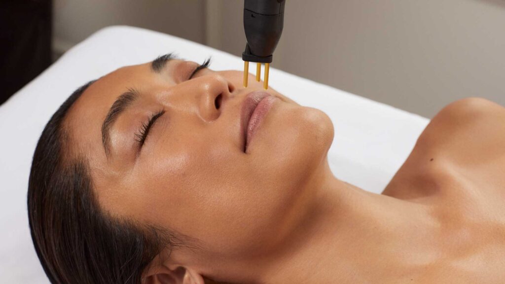NeoGen Plasma treatment at EF MEDISPA